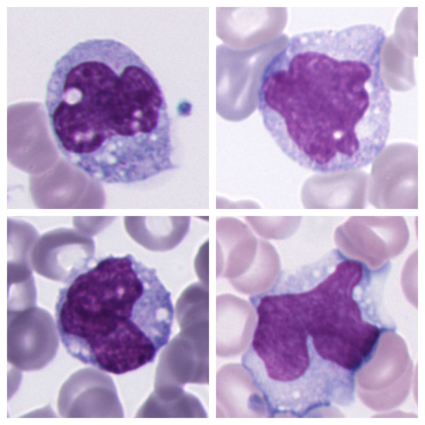 Monocyte