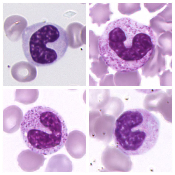 Neutrophil Band