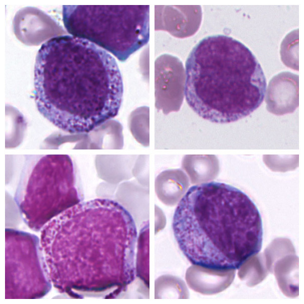 Promyelocyte